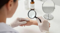 6 Signs Your Skin Needs Medical Attention, Stat