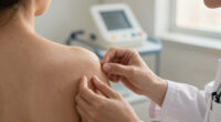 7 Common Misdiagnoses for Hidradenitis Suppurativa (HS)