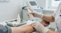 4 Best Hemostatic Sprays in 2026